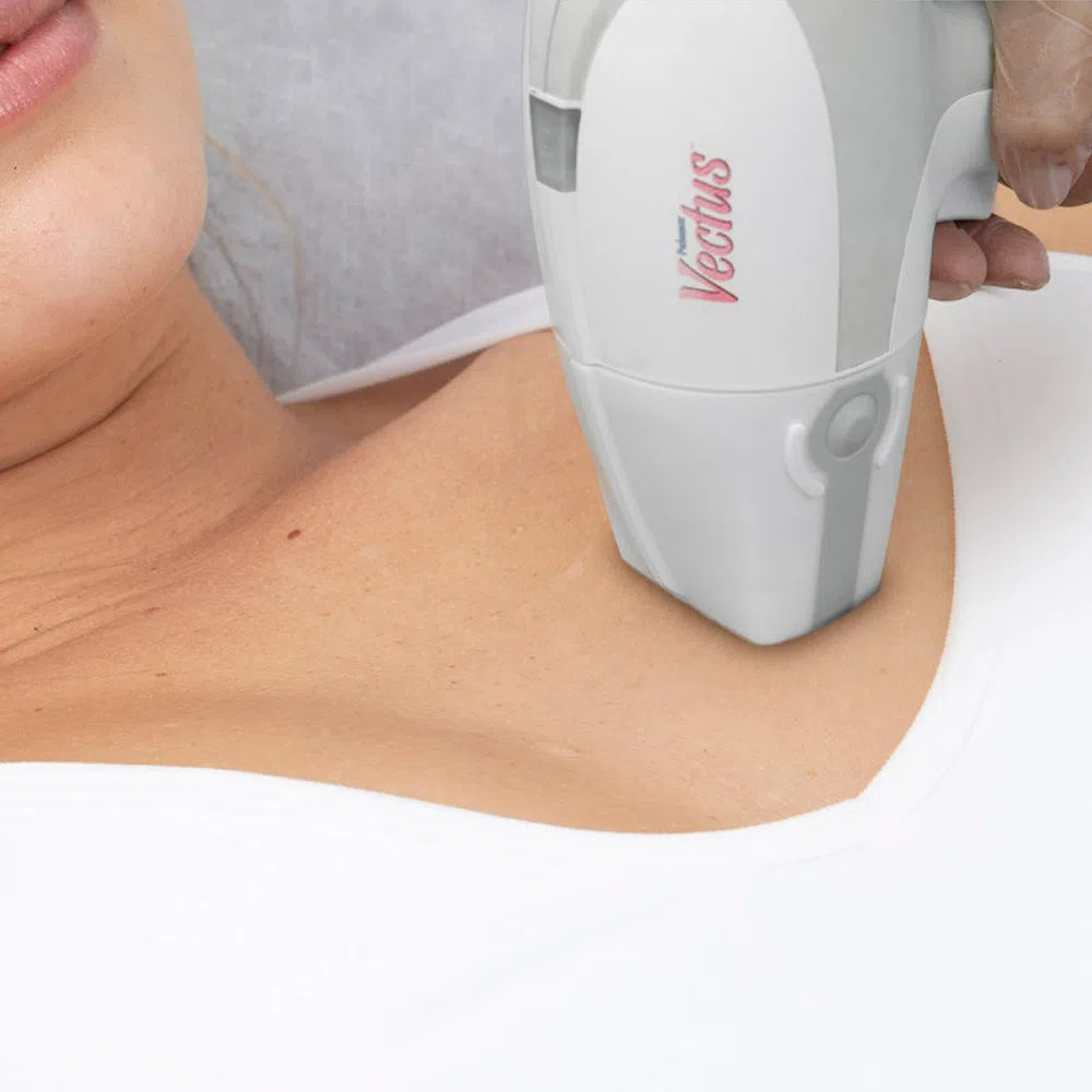 Vectus depilacion sale